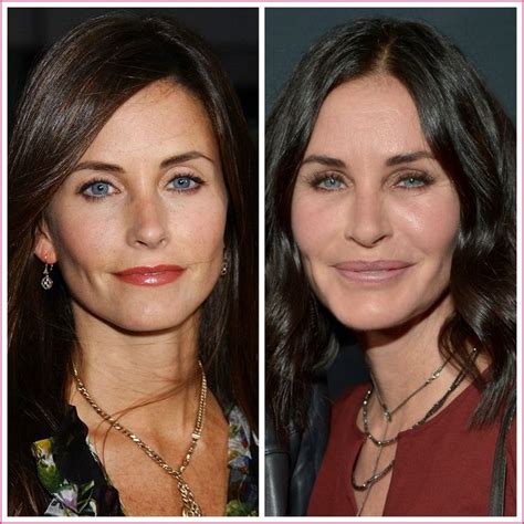 10 Worst Celebrity Plastic Surgery Before And After P Vrogue Co 10 Worst Celebrity Plastic Surgery Before And After P Vrogue Co