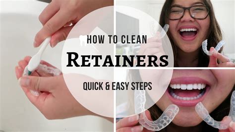 15 How To Clean Clear Retainers After Braces Ideas Inspireado 15 How To Clean Clear Retainers After Braces Ideas Inspireado