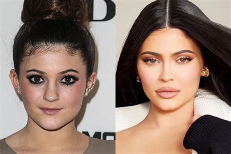 All The Kardashian Jenners Plastic Surgery Procedures Girlfriend All The Kardashian Jenners Plastic Surgery Procedures Girlfriend