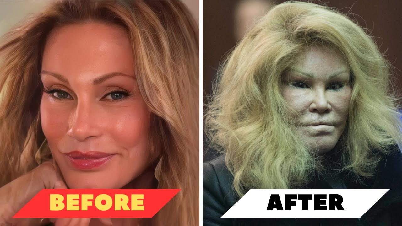 Celebrities Before And After Plastic Surgery Gone Wrong Celebrities Before And After Plastic Surgery Gone Wrong