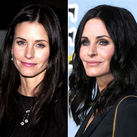 Celebrity Plastic Surgery Before And After