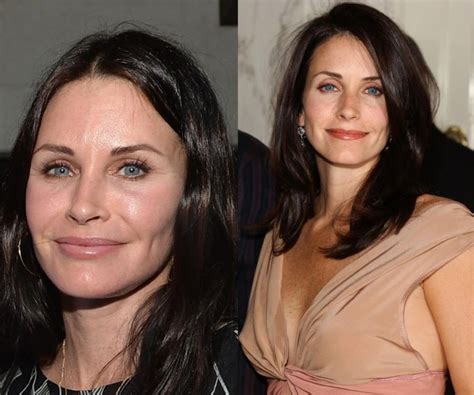 Courteney Cox Plastic Surgery