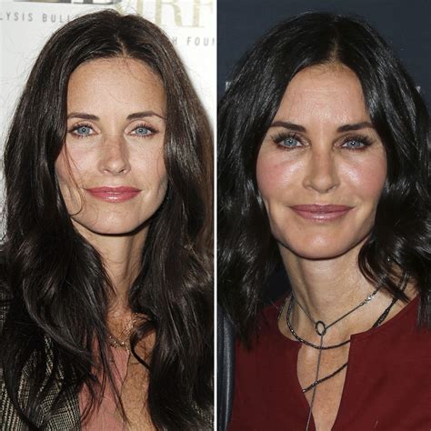 Courtney Cox Plastic Surgery Before And After Botox Cosmetic Procedures Courtney Cox Plastic Surgery Before And After Botox Cosmetic Procedures