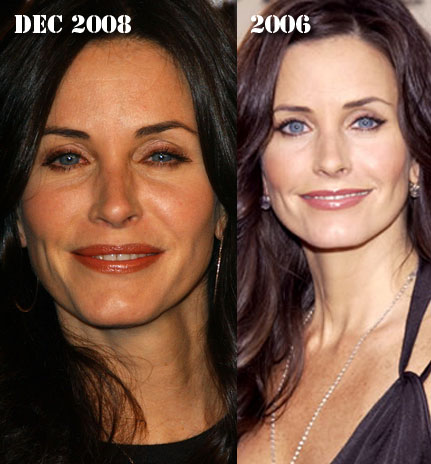 Courtney Cox Plastic Surgery