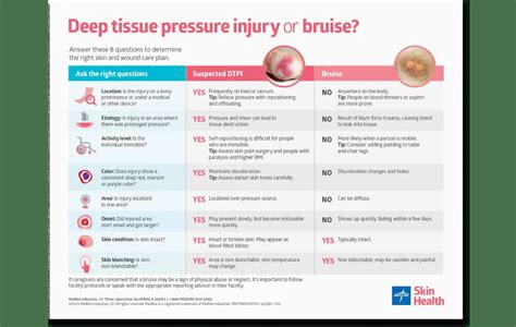 Deep Tissue Or Bruise Poster Medline Deep Tissue Or Bruise Poster Medline