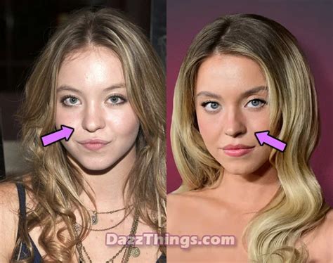Did Sydney Sweeney Get Plastic Surgery Transformation Photos Life Did Sydney Sweeney Get Plastic Surgery Transformation Photos Life