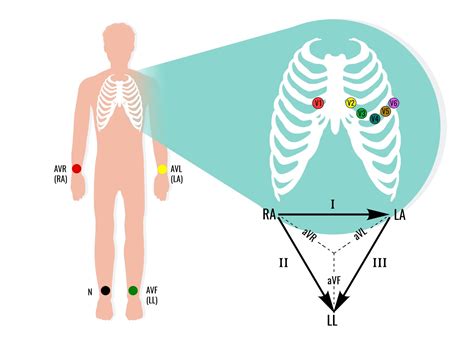 Ecg Electrodes