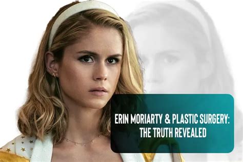 Erin Moriarty And Plastic Surgery The Truth Behind The Speculations Plasurgery Erin Moriarty And Plastic Surgery The Truth Behind The Speculations Plasurgery