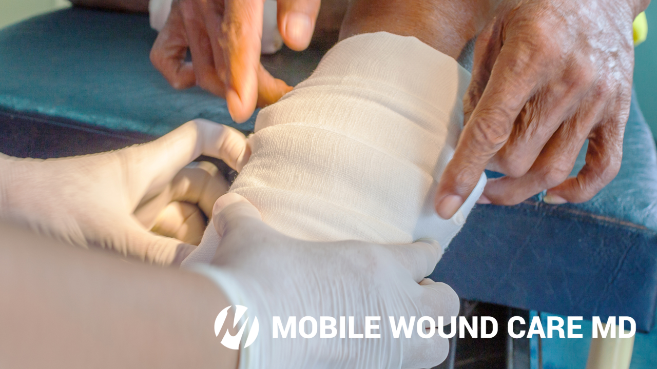 Expert Insights On Wound Tunneling Expert Insights On Wound Tunneling