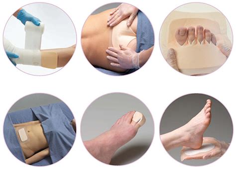Foam Dressing