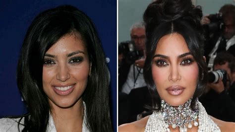 Kim Kardashian Before And After Plastic Surgery Timeline Kim Kardashian Before And After Plastic Surgery Timeline