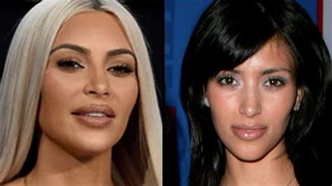 Kim Kardashian Face Before Plastic Surgery