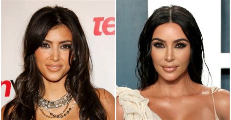 Kim Kardashian Plastic Surgery Before And After Kim Kardashian Plastic Surgery Before And After