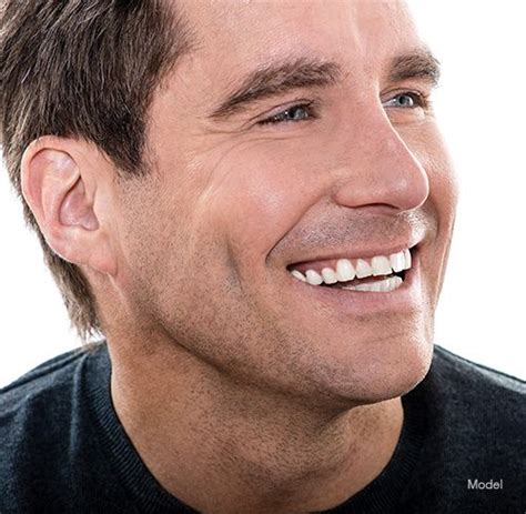 Male Eyelid Surgery Miami Fl Careaga Plastic Surgery Male Eyelid Surgery Miami Fl Careaga Plastic Surgery