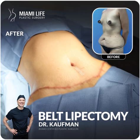 Miami Life Plastic Surgery