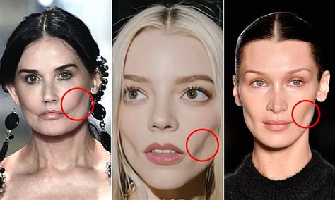 Plastic Surgeon Reveals Which Celebrities Had Buccal Fat Removal Surgery And Why They Ll Regret It Daily Mail Online Plastic Surgeon Reveals Which Celebrities Had Buccal Fat Removal Surgery And Why They Ll Regret It Daily Mail Online