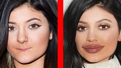Plastic Surgery Before After