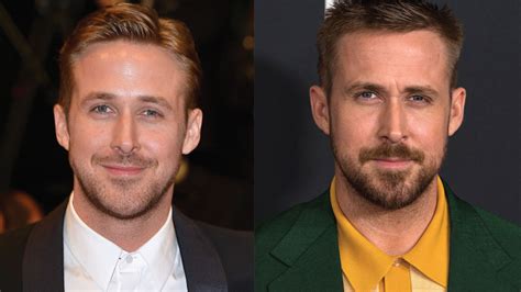 Plastic Surgery Ryan Gosling