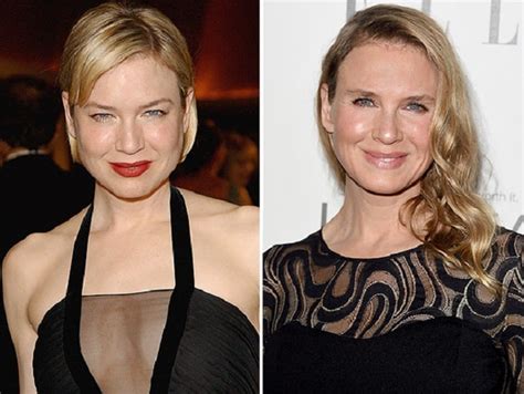 Renee Zellweger Before And After Plastic Surgery Botox Renee Renee Zellweger Before And After Plastic Surgery Botox Renee