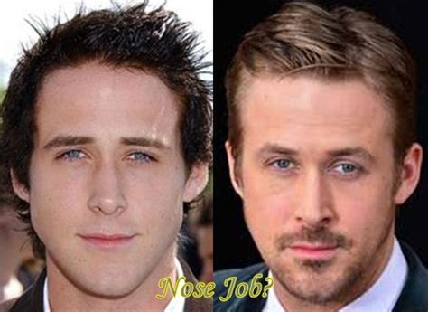 Ryan Gosling Plastic Surgery Before And After Latest Plastic Surgery Ryan Gosling Plastic Surgery Before And After Latest Plastic Surgery