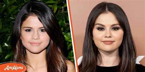 Selena Gomez Plastic Surgery