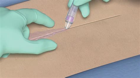 Skin Adhesive Glue
