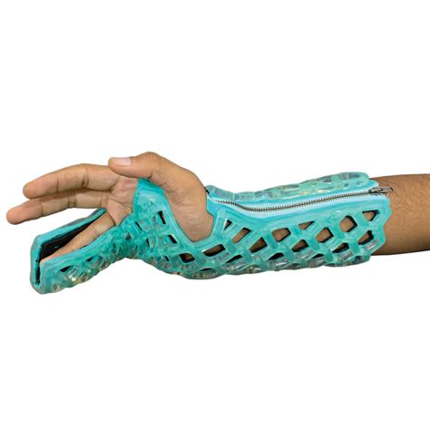 Ulnar Gutter Immobilizer Orthoheal Ulnar Gutter Immobilizer Orthoheal