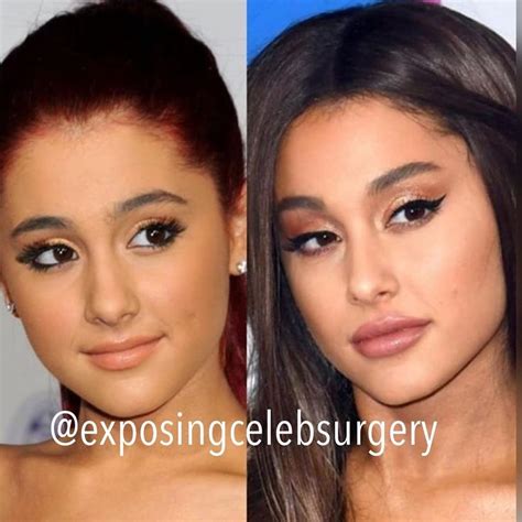 Why Celebrities Like Bella Hadid Ariana Grande And Kylie Jenner Are Why Celebrities Like Bella Hadid Ariana Grande And Kylie Jenner Are